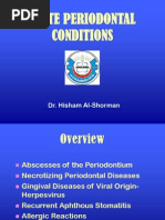 Download Acute Periodontal Conditions by Prince Ahmed SN191448377 doc pdf