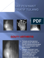 Radiologi Degeneratif Tulang