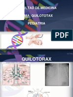 Quilotoraxx