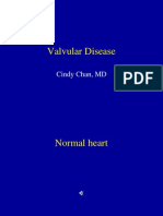 Valvular Diseases - Students