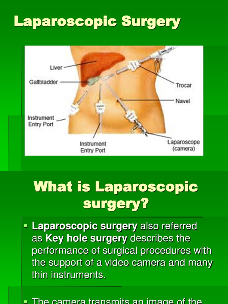 Laparoscopic Surgery | PDF