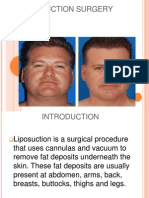 Liposuction Surgery