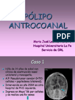 Polipo Antrocoanal