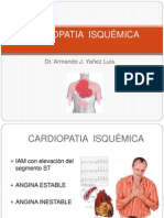 Cardiopatia Isquémica