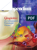 Profed Art Gingivitis Inflammatory Periodontal Disease
