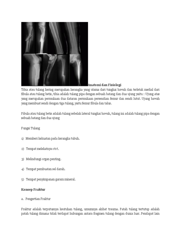 Anatomi Dan Fisiologi Fraktur Tibia Fibula | PDF | Sains & Matematika