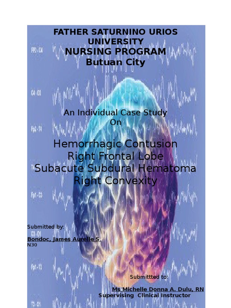 Right Convexity Subdural Hematoma Case Study | PDF | Cerebrospinal ...