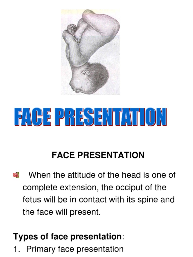 what is face presentation in birth