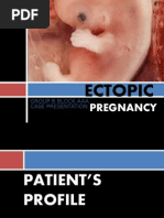 Download ECTOPIC PREGNANCY edited by ainiesam27 by ainie SN19399009 doc pdf