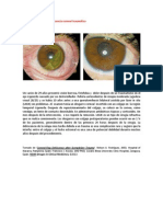 A primera vista 407 (Dehiscencia corneal traumática).docx