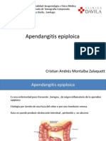 Apendangitis Epiploica