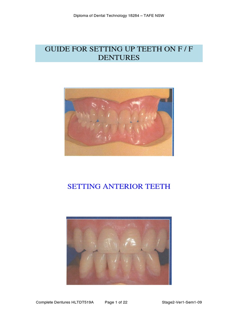 Guide for Setting Denture Teeth on Ff Dentures Tooth