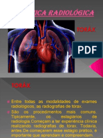 Radiografia Do Torax -01.