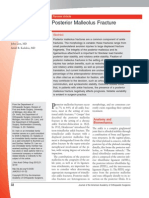 Posterior Malleolus Fracture