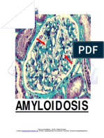 Amyloidosis