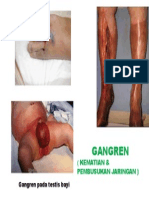 Gambar Ganggren DM