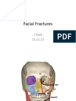 Facial Fractures 15.11.13