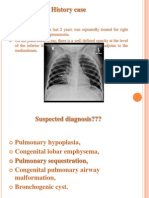 Congenital Lung Malformations