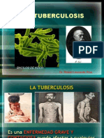 Tuberculosis