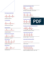 EKG Abnormal