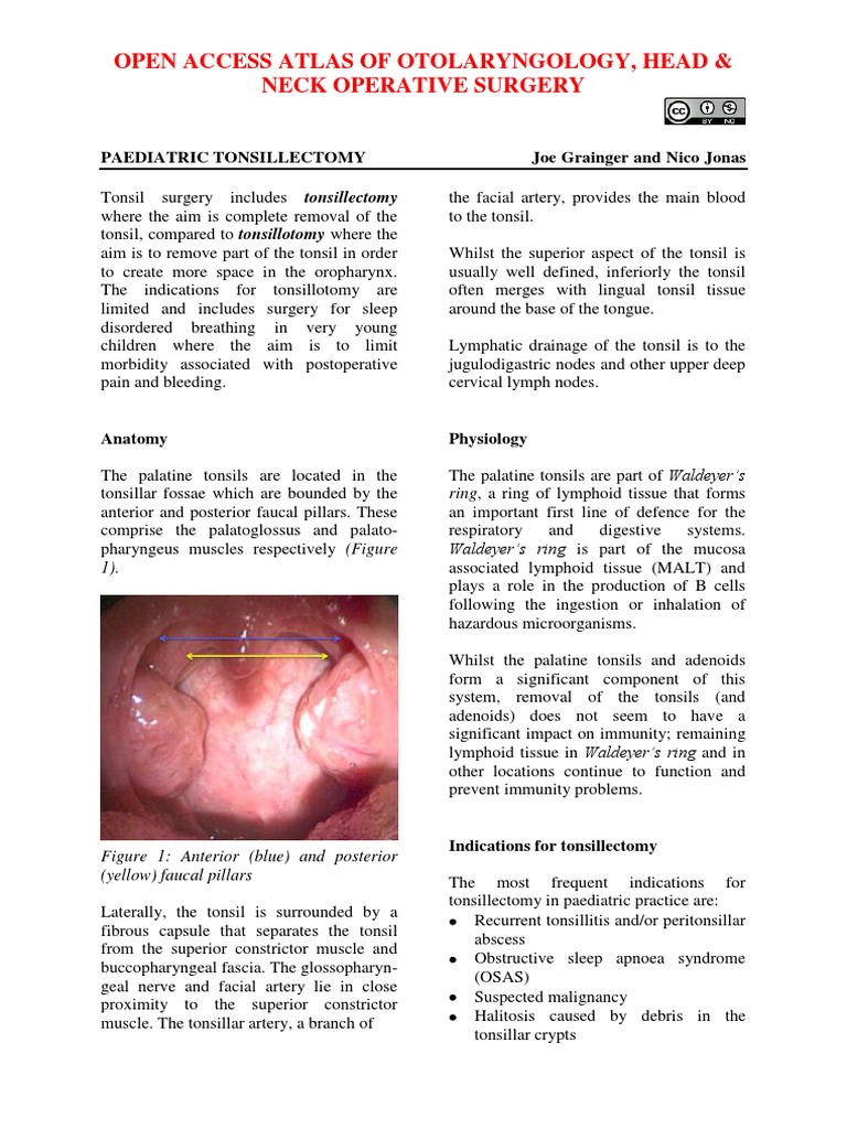 Paediatric Tonsillectomy Pdf