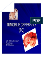 Curs 6-Tumori Cerebrale