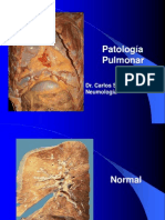 Patologia Pulmonar - Español