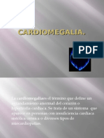 Cardiomegalia