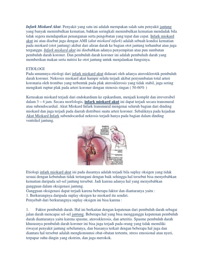 Infark Miokard Akut Pdf