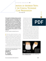 Direct Restoration of Anterior Teeth