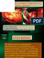 Aneurisma de Aorta Toracica - Abdominal