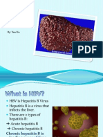 Hepatitis B Presentation
