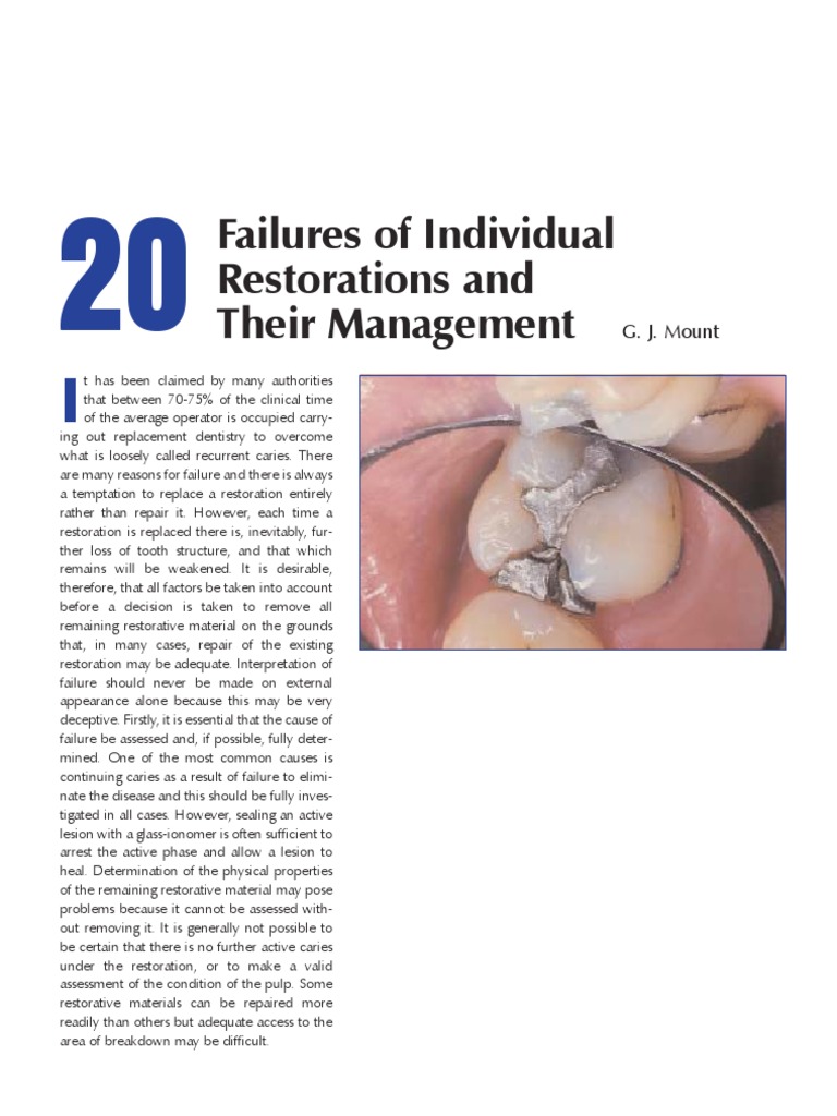 20 Failures of Individual Restorations N Their Management | PDF ...