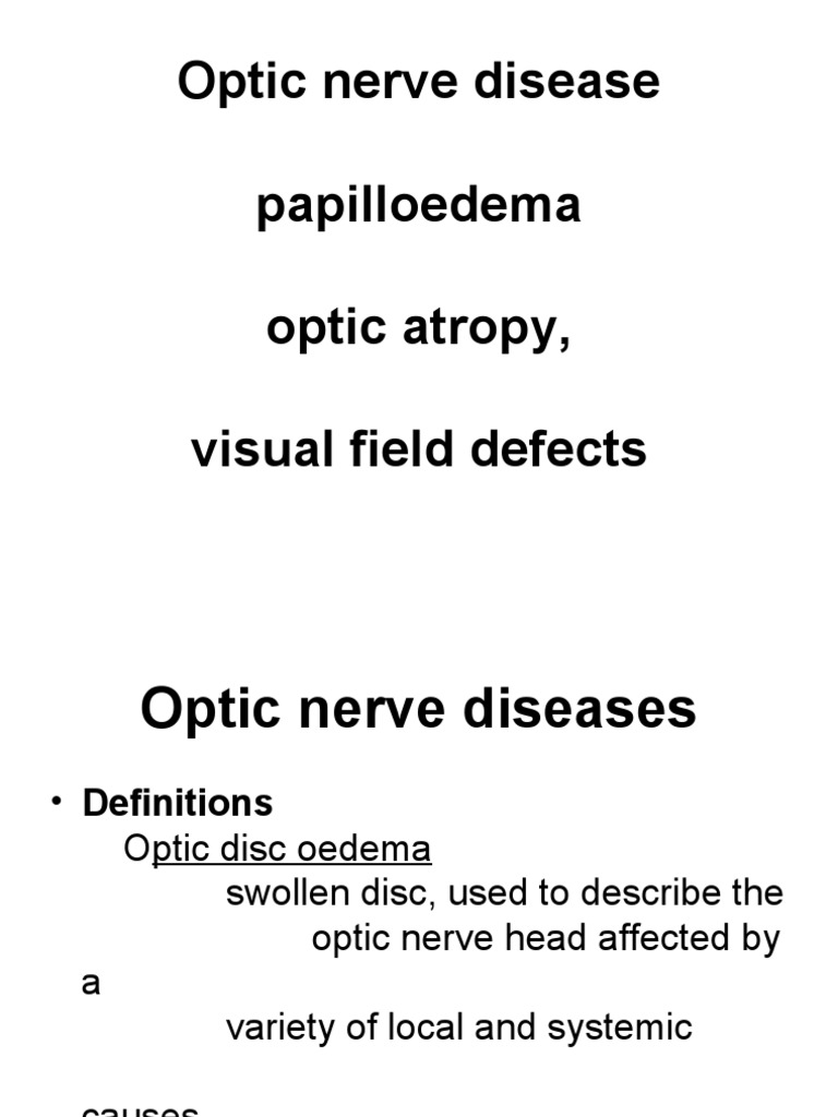 Optic Nerve Disease, Papillaedema Optic Atropy, Visual Field PDF