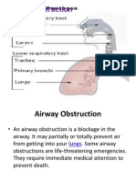 Air Wa Obstruction
