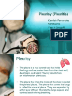 Pleurisy (Pleuritis)