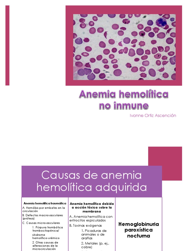 Causas de Anemia Hemolítica Adquirida | PDF | Glóbulo rojo | Anemia