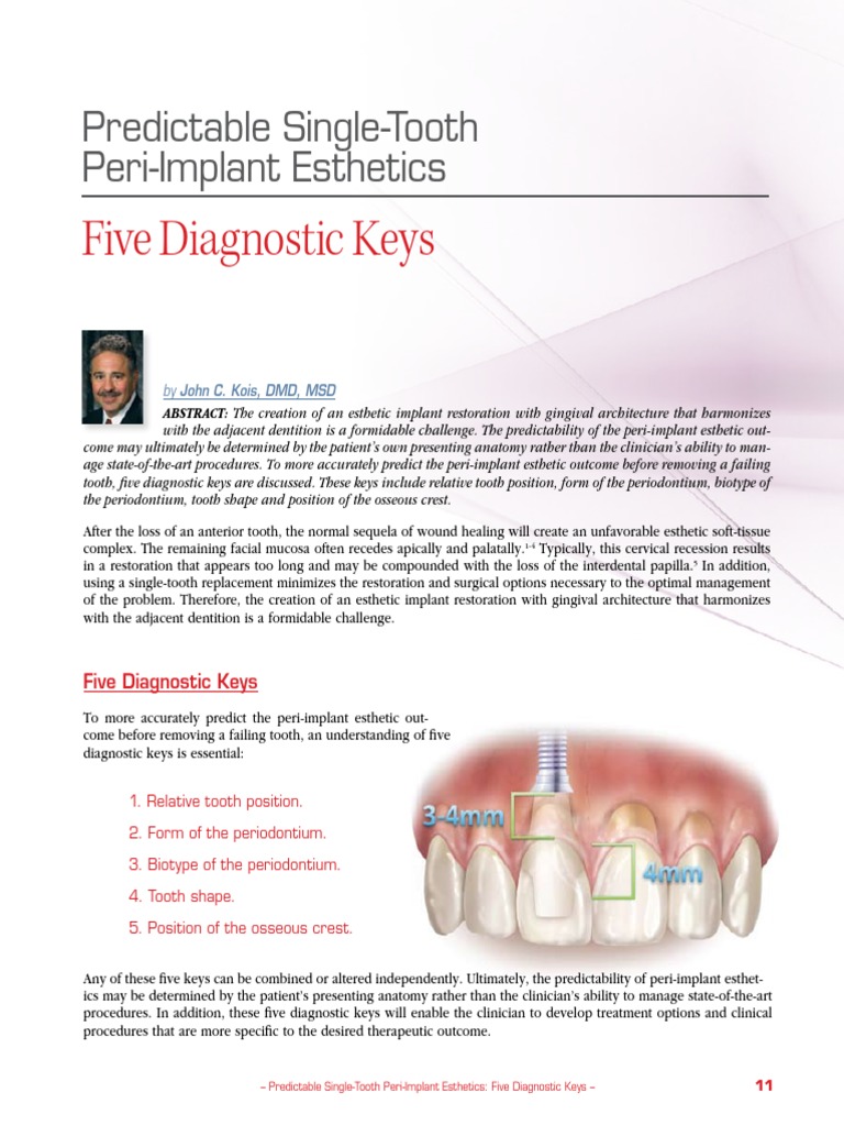 IMv12kois Dental Implant Facial Features