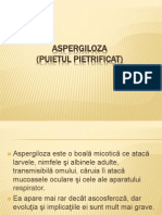 Aspergiloza