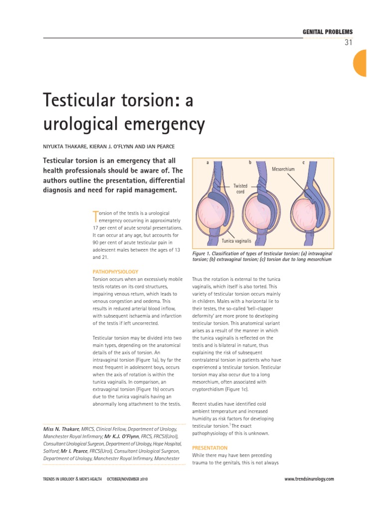 Testicular Torsion A Urological Emergency Requiring Rapid Diagnosis