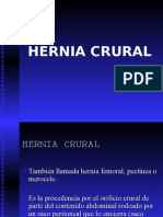 Hernia Crural Ipn 2003-4