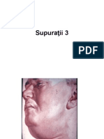 Supuraţii 3