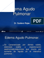 Edema Agudo Pulmonar 5. - Eap17380