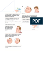 How To Use Eye Ointments