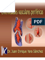 Enfermedades vasculares perifericas