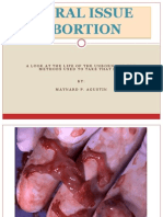 abortion-111102005810-phpapp01