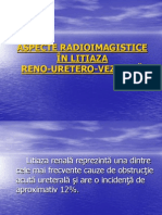 Aspecte Radioimagistice În Litiaza Reno-Uretero-Vezicala