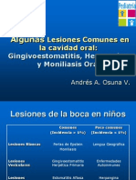 Dr. Andrés Osuna Algunas lesiones comunes en la cavidad oral.ppsx