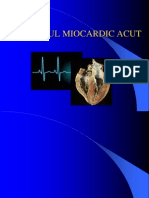 Infarct Miocardic Acut