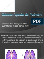 Edema Agudo de Pulmon